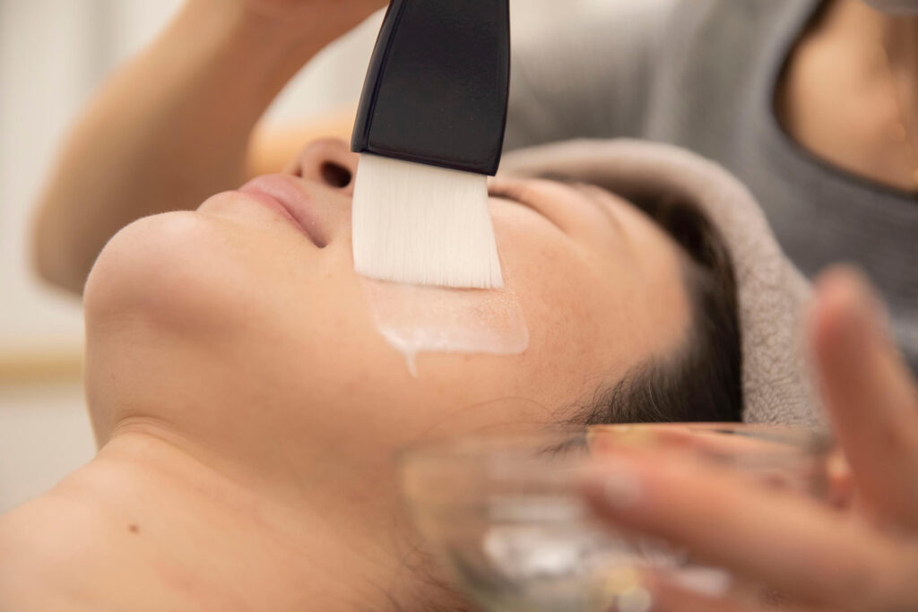 リアルクリニックの施術の様子 ピーリング