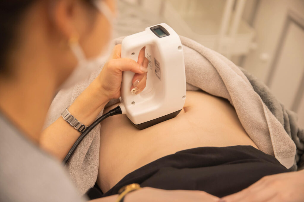 リアルクリニックの医療機器 inmode