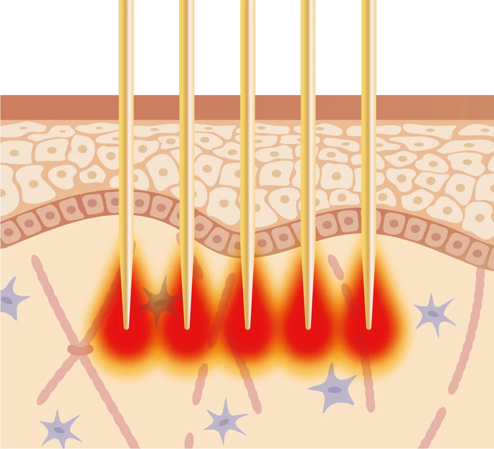 Dual Wave and Treatmnet Mechanisms CW part 2