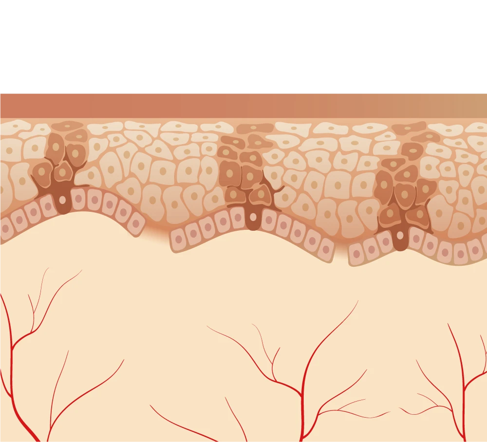 Dual Wave and Treatmnet Mechanisms PW part 1