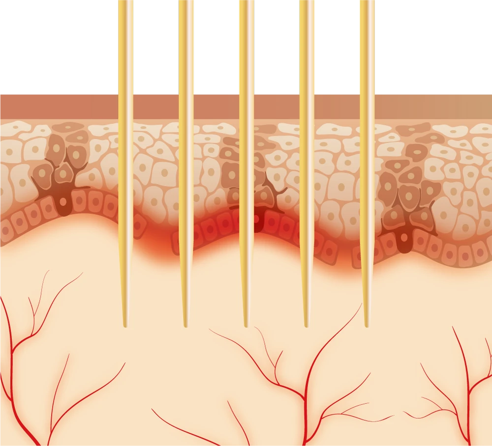 Dual Wave and Treatmnet Mechanisms PW part 2