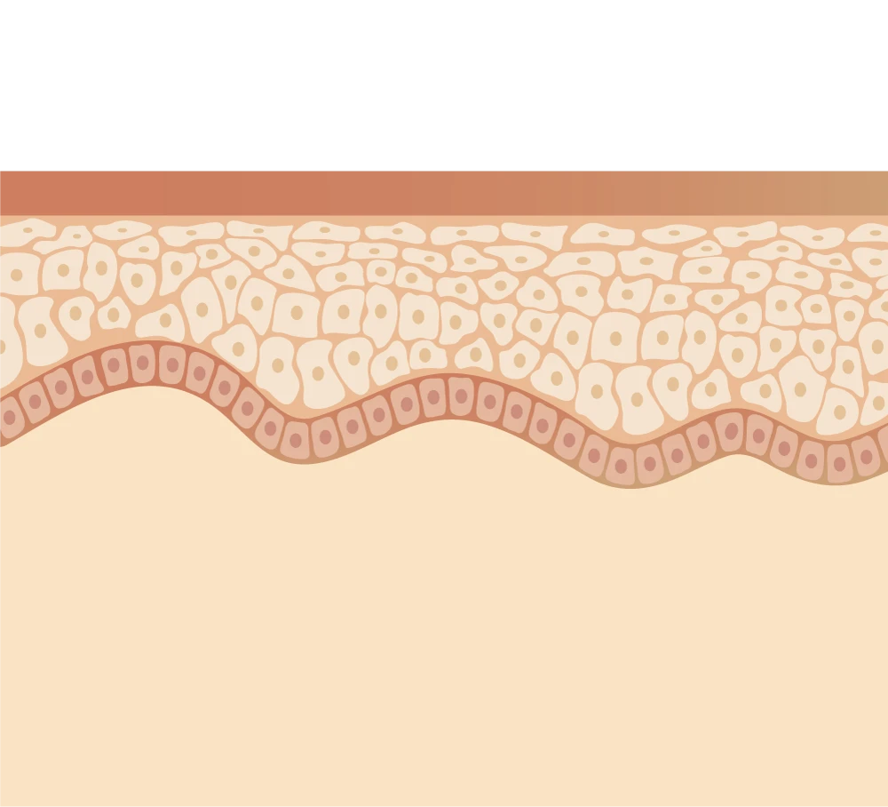Dual Wave and Treatmnet Mechanisms PW part 3