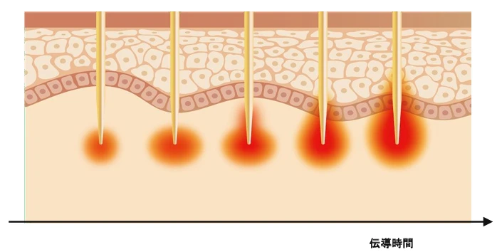 シルファーム X ポイント3