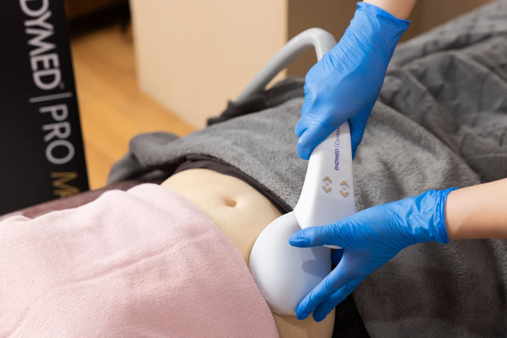 エンディメッド・プロ・マックス（Endymed Pro Max）