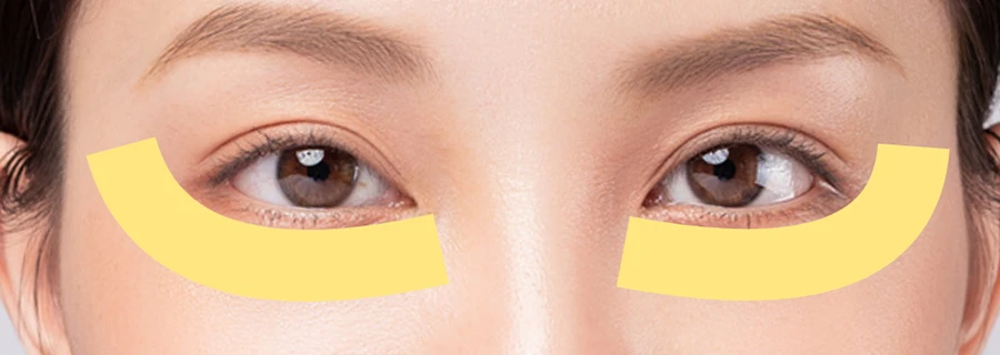 EndyEYEの施術範囲