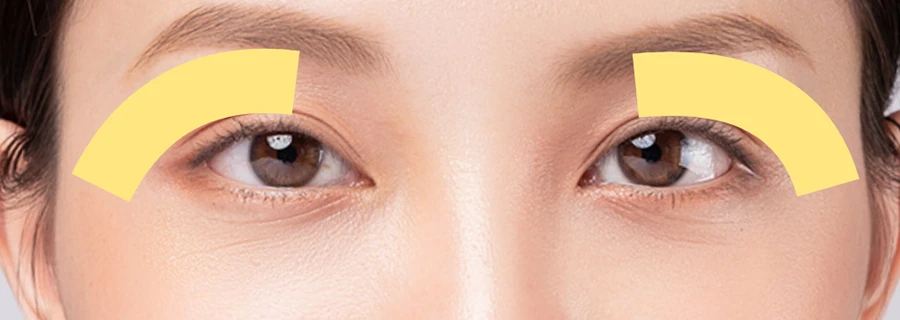 EndyEYEの施術範囲