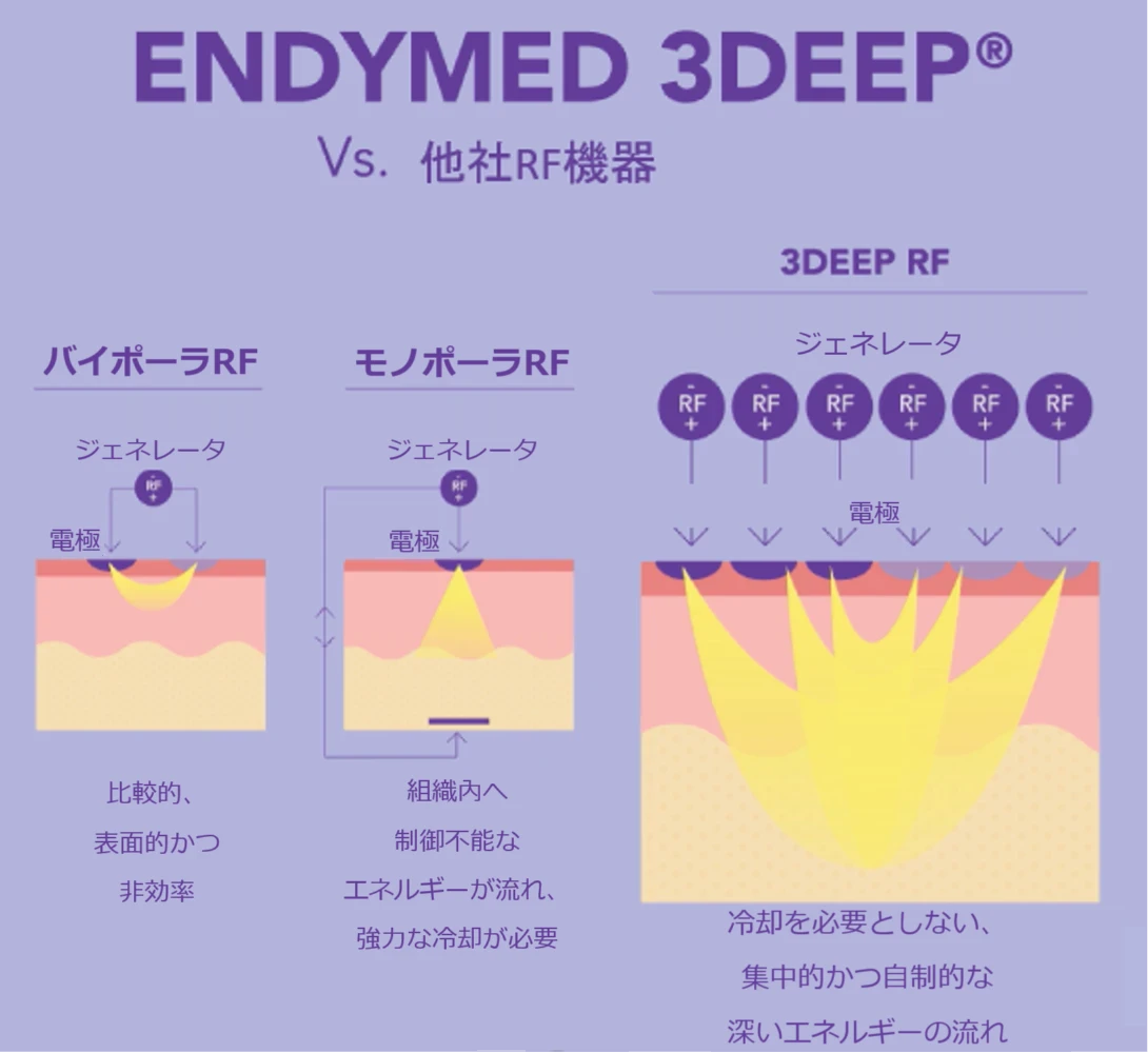 ENDYMED 3DEEPと他社RF機器との比較