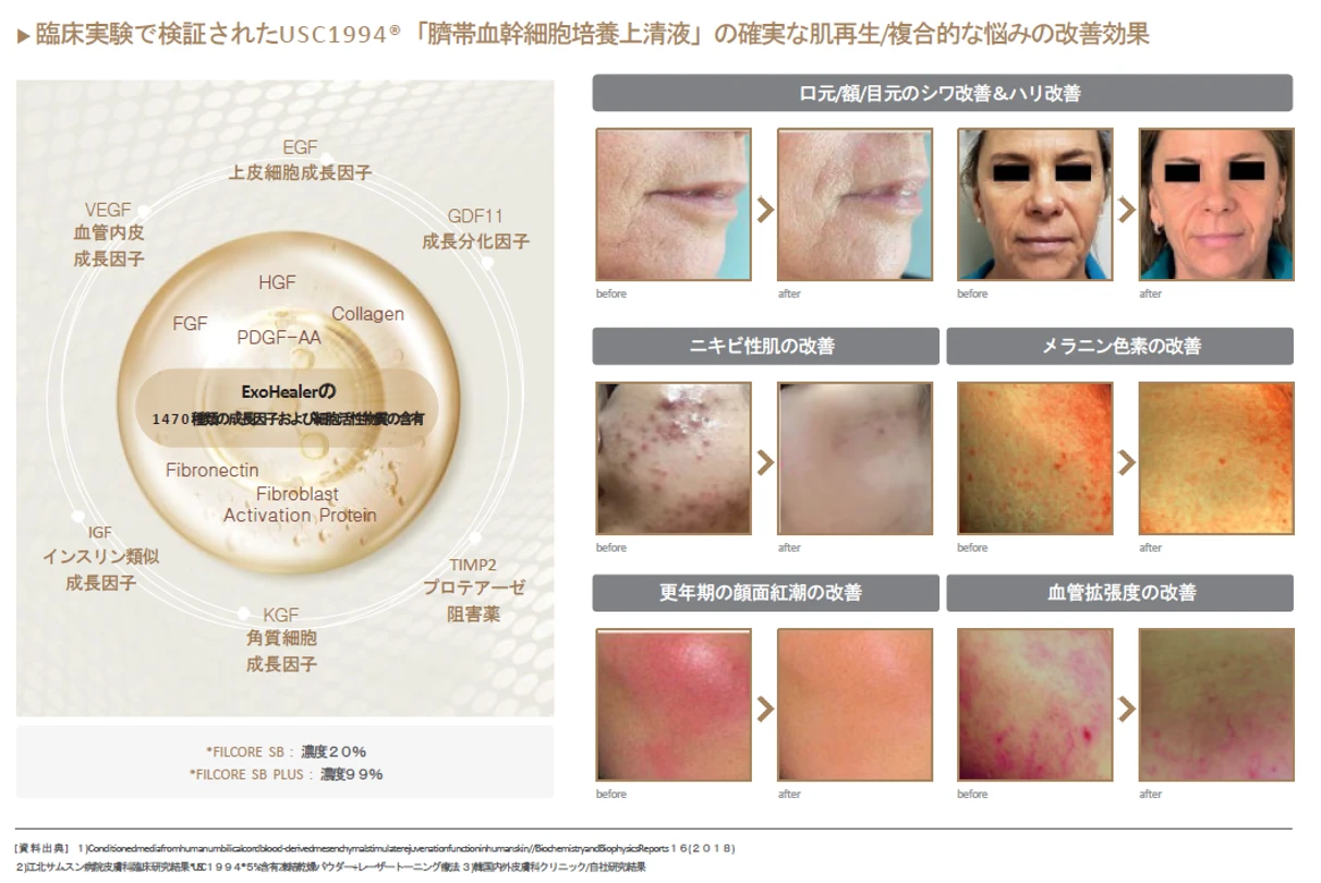 エクソヒーラーSBプラス（水光注射）