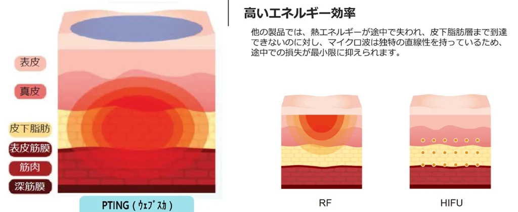 PTING｜高いエネルギー効果